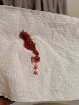 I awoke to some pink on the toilet paper, which scared me, but I figured I. . Bright red gush of blood early pregnancy